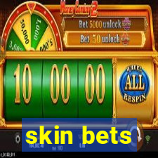 skin bets