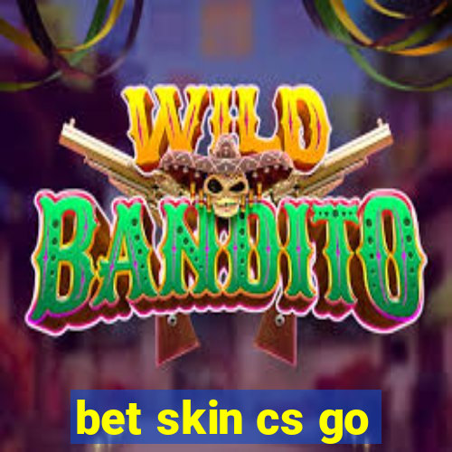 bet skin cs go