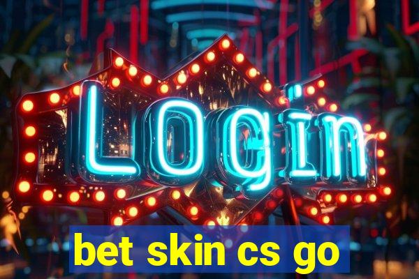 bet skin cs go