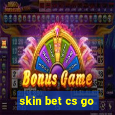 skin bet cs go