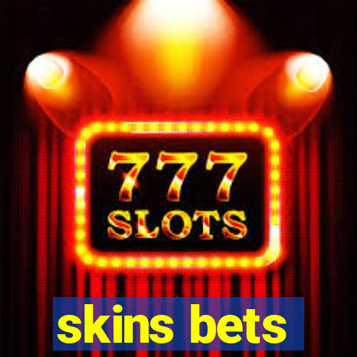 skins bets