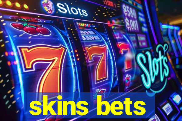 skins bets